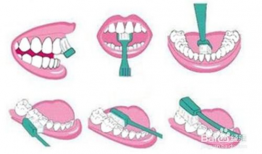 刷牙正确方法视频,守护口腔健康